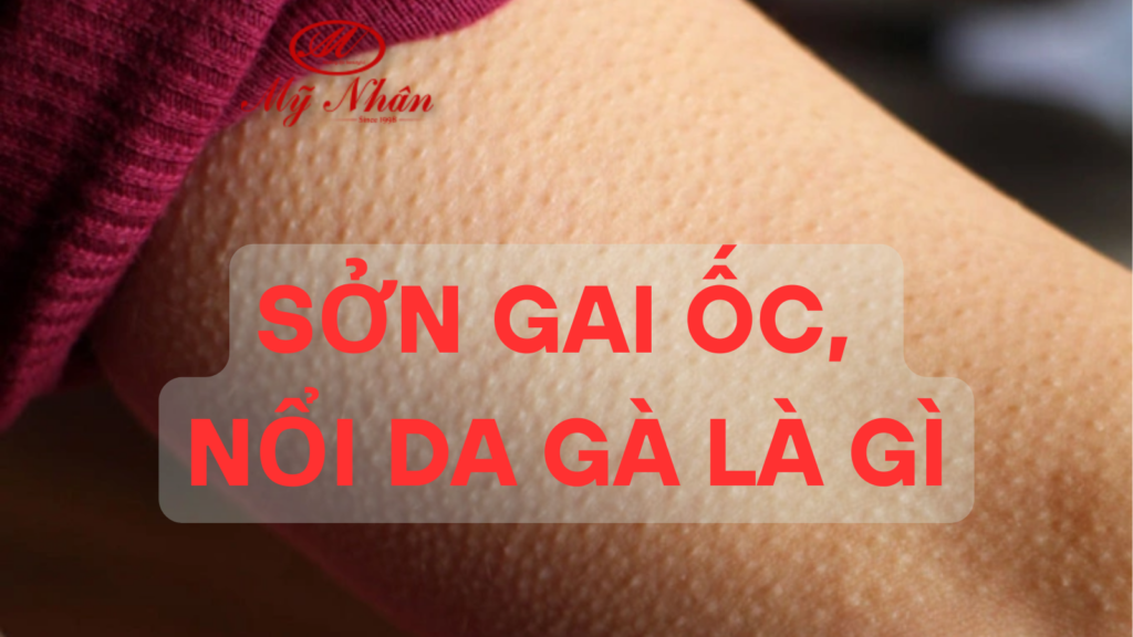 Sởn Gai Ốc Nổi Da Gà Là Gì
